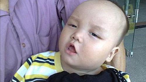 吃田瓜舌头疼,揭秘舌尖上的健康之谜